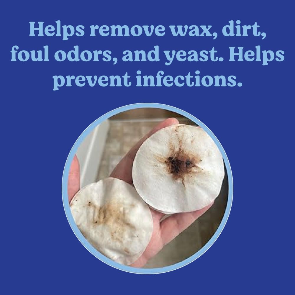 ANGELS' EYES Ear Cleansing Wipes for Dogs & Cats, Removes Dirt, Wax, Odor, Help Reduce Infections & Itching, No Artificial Colors or Fragrance, 100ct