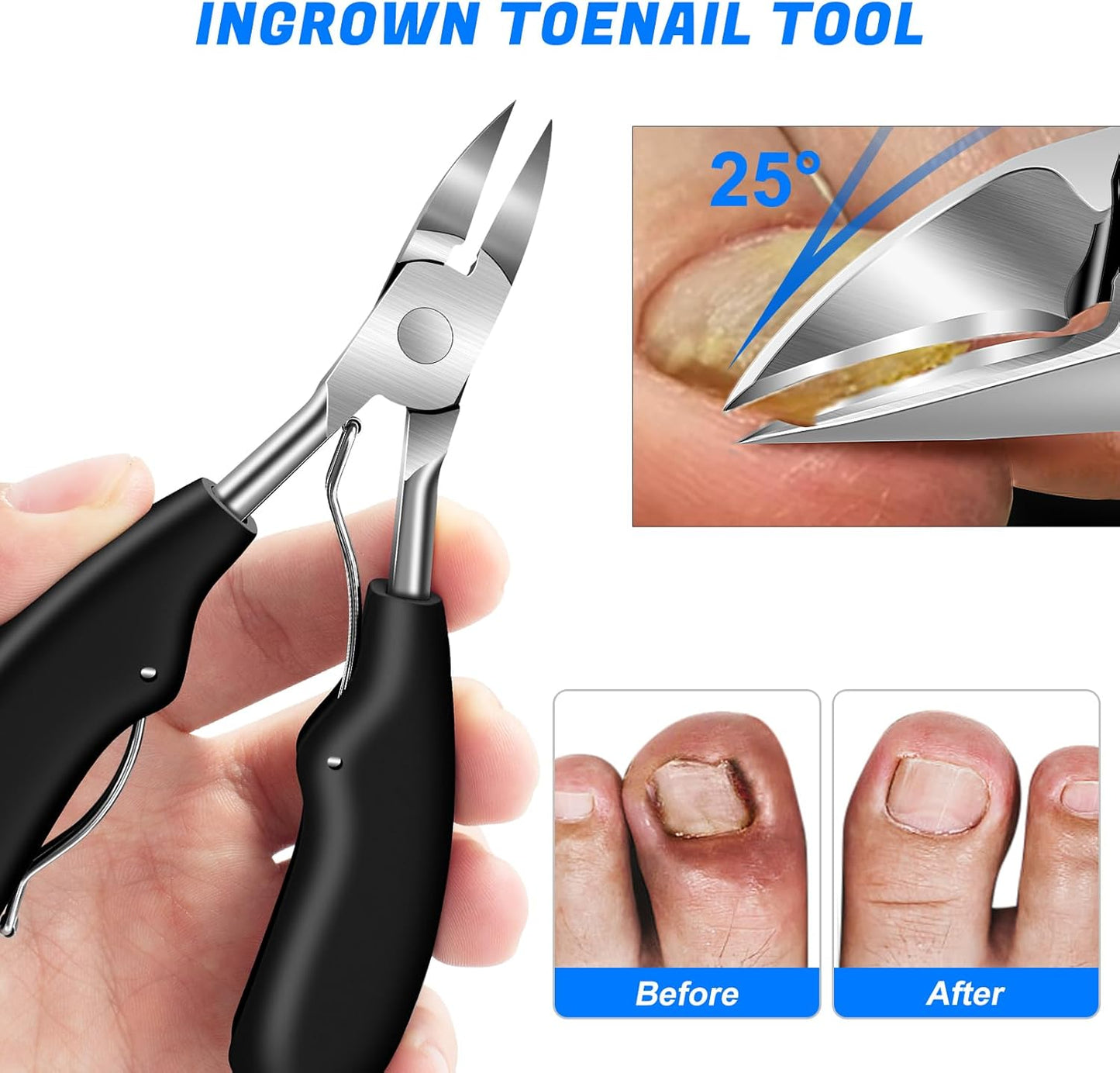 Toenail Clippers for Seniors Ingrown Thick Toenails, 2025 Angled Head Toe Nail Clippers with Catcher, Heavy Duty 45° Slanted Toenail Clippers, 37mm Wide Opening Nail Cutter with Long Handle, 6PCS